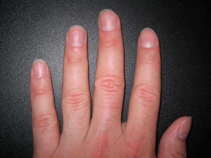 Изменение цвета пальцев