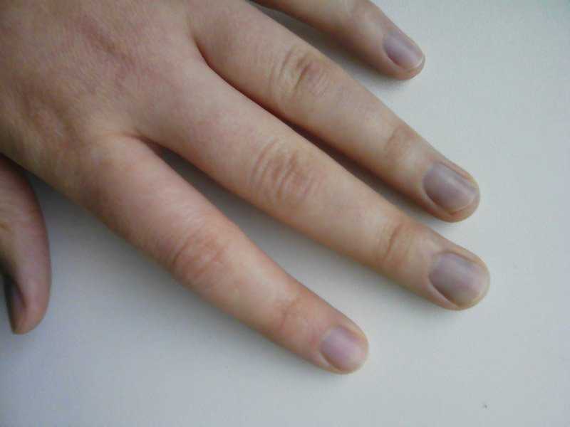 Изменение цвета ногтей