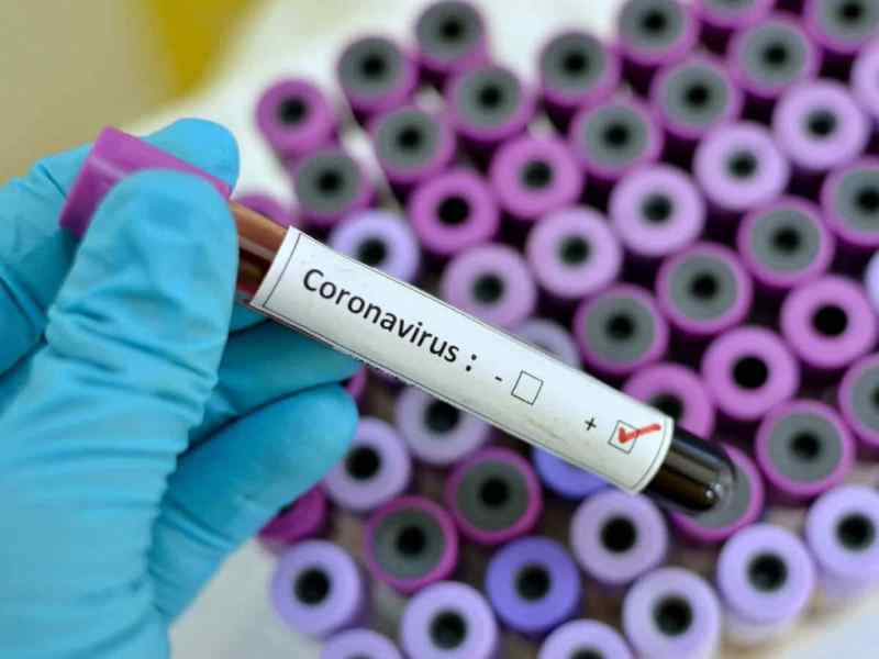 Коронавирус: во Владимирской области зафиксированы 66 новых случаев