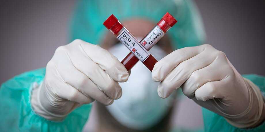 Во Владимирской области за сутки подтвердились 34 случая коронавируса