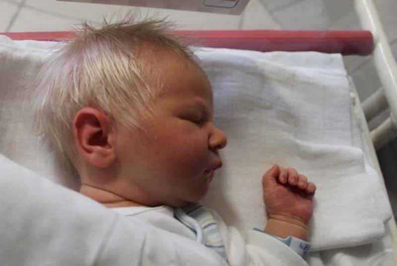 Малыш с седыми волосами: особенность или альбинизм