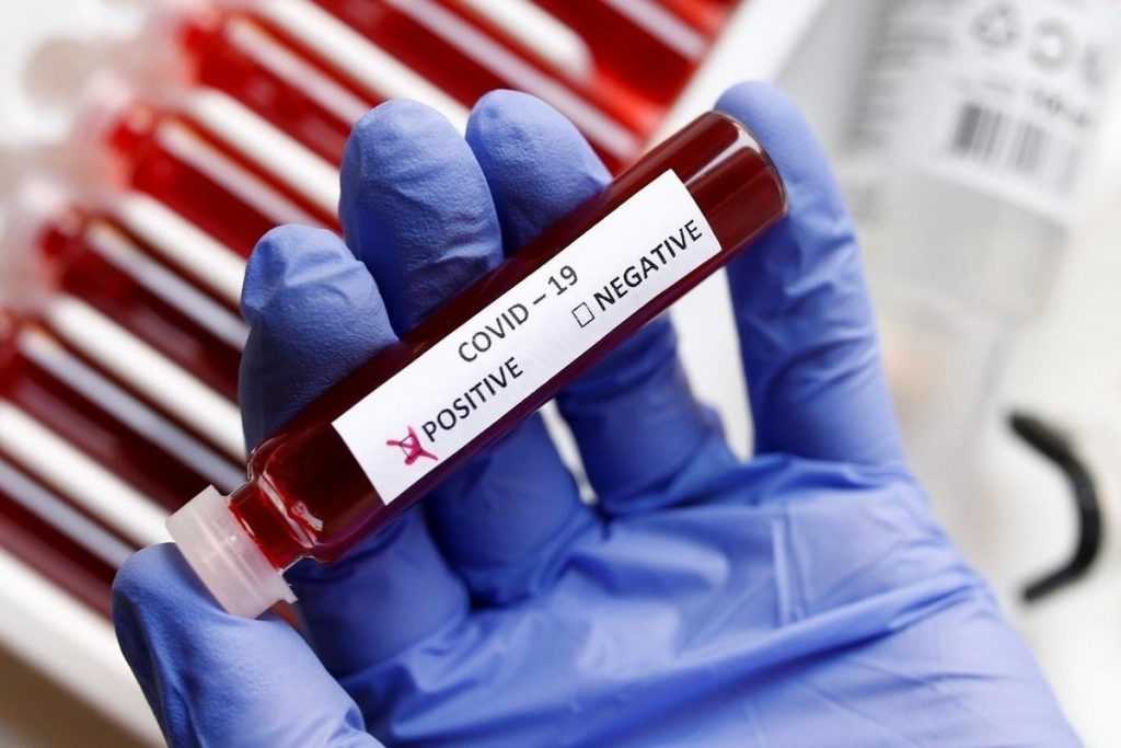Во Владимирской области за минувшие сутки заболели коронавирусом 158 человек