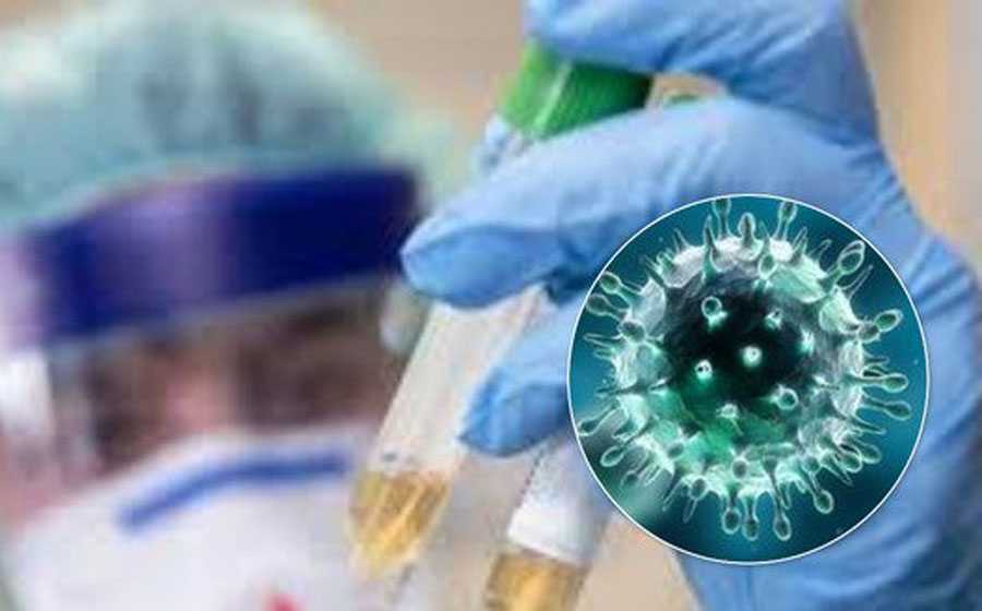 Во Владимирской области лабораторно подтвердились 162 новых случая заболевания Covid-19