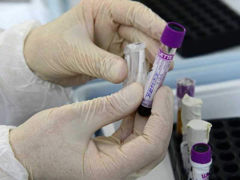 ВОЗ рекомендует к использованию российский тест для выявления коронавируса