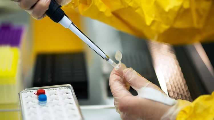 Новая угроза: В ЮАР выявили еще один коронавирус NeoCoV