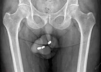 Фото: Urology Case Reports