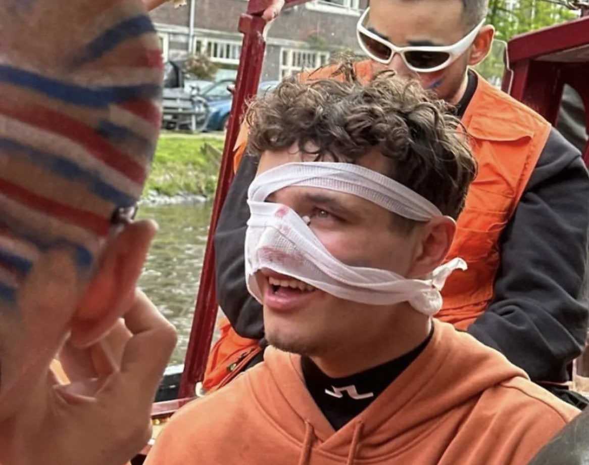 Гонщик McLaren Ландо Норрис травмировал лицо на Дне короля в Амстердаме